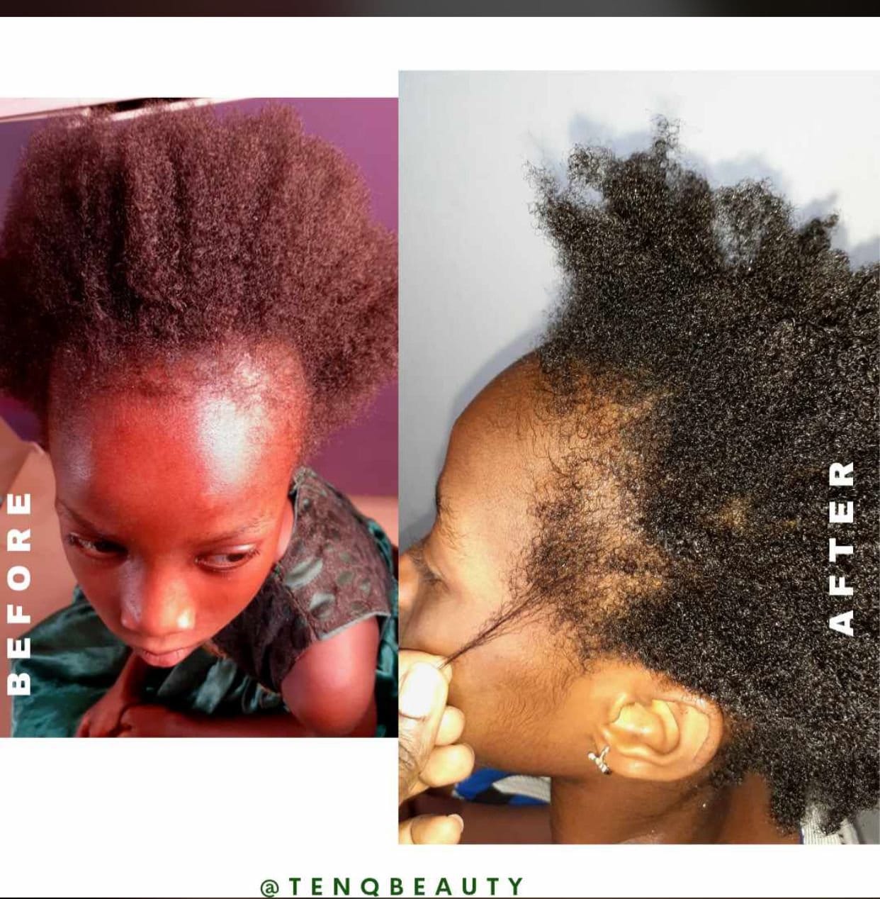 Hair Care Edges Growth Oil, Hair Growth Oil, Scalp Serum, Keratin, Dreadlock Care, All Types of Hair - Glo Cre8s